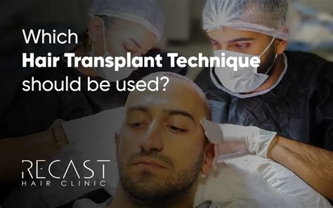 Which hair transplant technique should be used? - Recast Hair Transplant