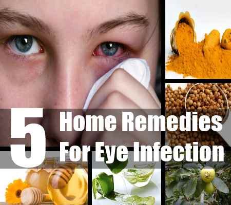 Five Home Remedies For Eye Infection – Natural Home Remedies & Supplements