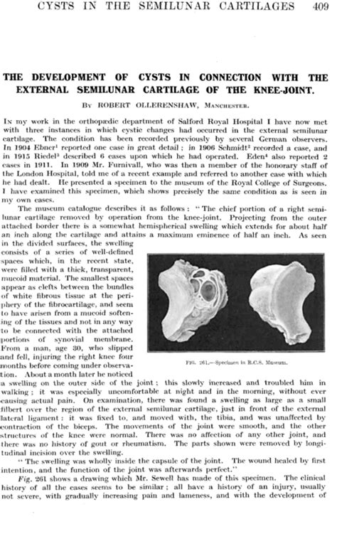 The development of cysts in connection with the external semilunar cartilage of the knee‐joint ...