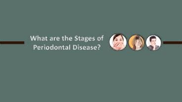 PPT – What are the Stages of Periodontal Disease PowerPoint presentation | free to download - id ...