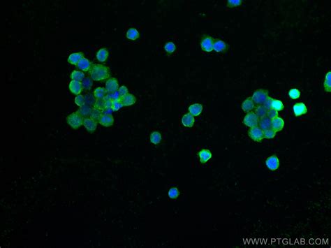 CD68 antibody (65187-1-Ig) | Proteintech