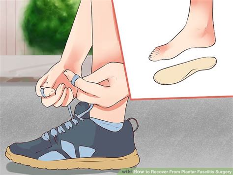 How to Recover From Plantar Fasciitis Surgery: 15 Steps