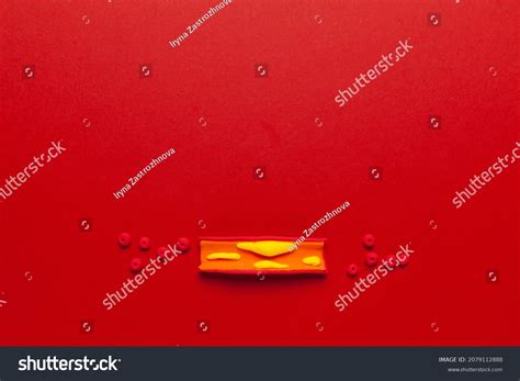 749 Plaque in veins Stock Photos, Images & Photography | Shutterstock