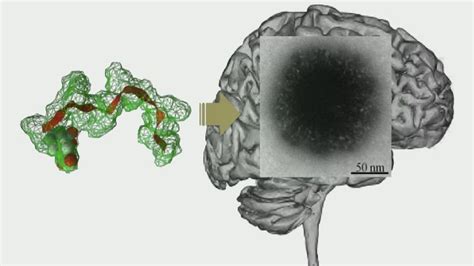 Bypassing the Blood-Brain-Barrier: Delivering Drugs to the Brain ...