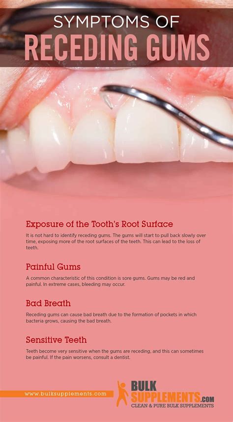 Receding Gums: Symptoms, Causes & Treatment