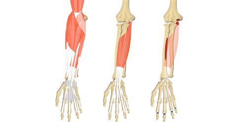 Flexor Digitorum Superficialis Innervation - cloudshareinfo