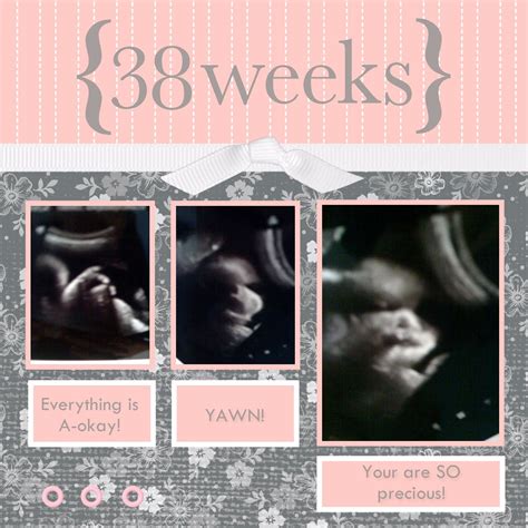 Letters to Stella Rose: 38 Week Ultrasound