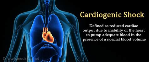 Cardiogenic Shock - Causes, Symptoms, Diagnosis, Treatment & Prevention