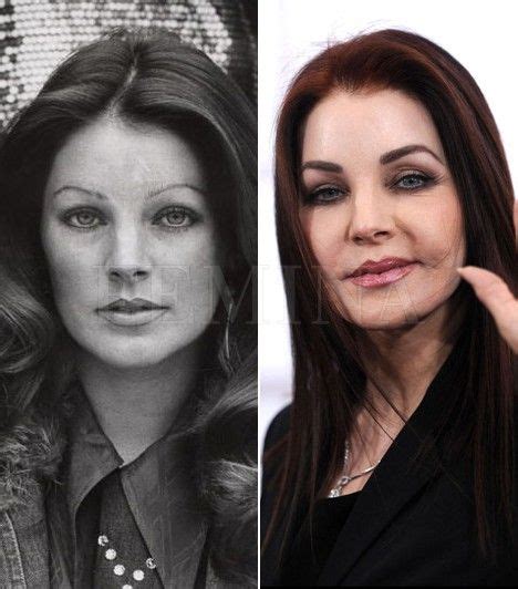 Priscilla presley plastic surgery before and after facelift pictures ...