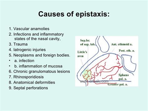 The Story Of Epistaxis Causes Has Just Gone Viral! | epistaxis causes ...