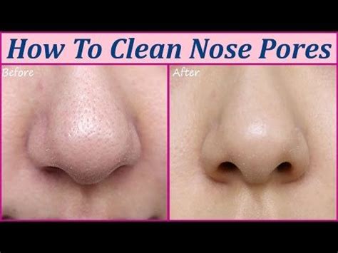 7 Unclogging Pore Treatments That Will Change Your Life | Byrdie | Nose pores, Clean nose pores ...