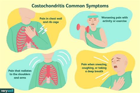 Costochondritis | MyBeautyGym