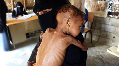 World Faces Looming Hunger Crisis