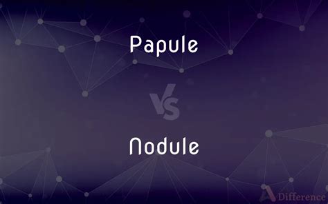 Papule vs. Nodule — What’s the Difference?