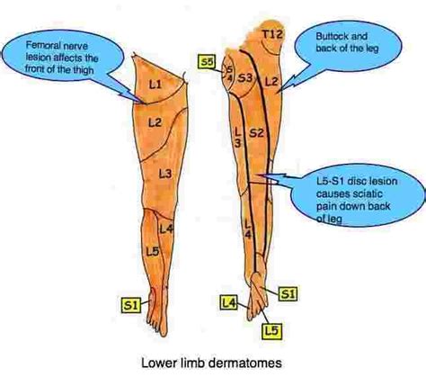 Pin on sciatic neve