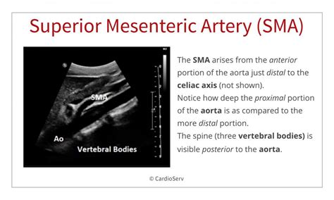 Abdominal Ultrasound for Echocardiographers: Branches of the Aorta ...