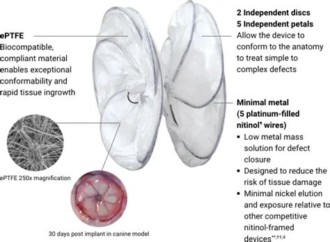 Top 199+ Atrial septal defect animation - Merkantilaklubben.org