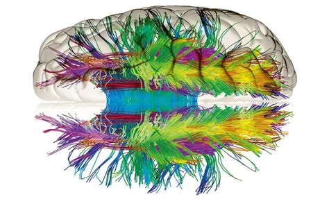 Comprensione delle reti neurali artificiali - NetAi