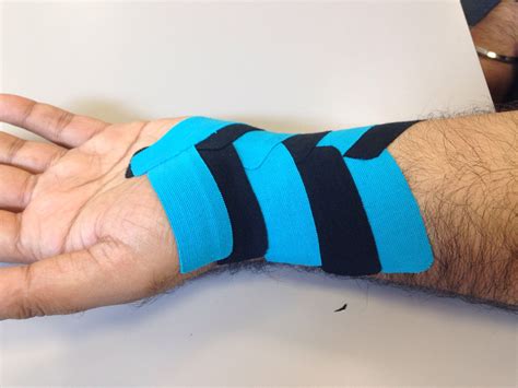 Kinesio Tape wrist | Kinesiology, Kinesiology taping, Kinesio taping