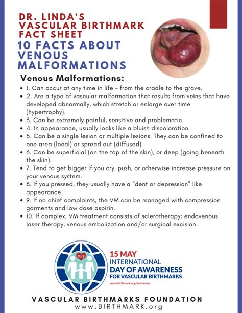 Venous Vascular Malformation