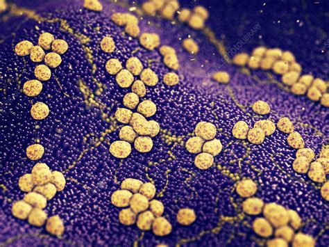 Staphylococcus bacteria on skin, illustration - Stock Image - F023/8649 - Science Photo Library