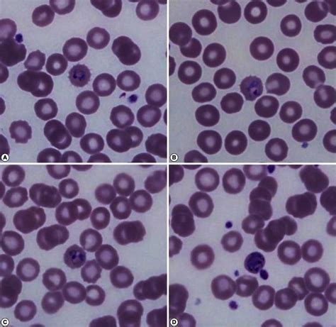 Hem6 Peripheral Blood Smear Wright Giemsa Stained Per - vrogue.co