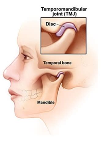 Temporomandibular Joint Diagram