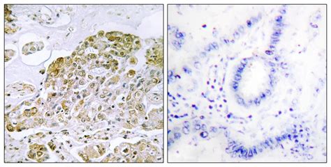 TFEB Antibody (OAAF02178) | Aviva Systems Biology | Avivasysbio.com