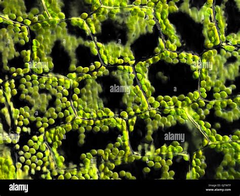 Plant Cell Chloroplast Microscope