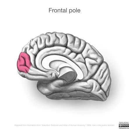 Image | Radiopaedia.org