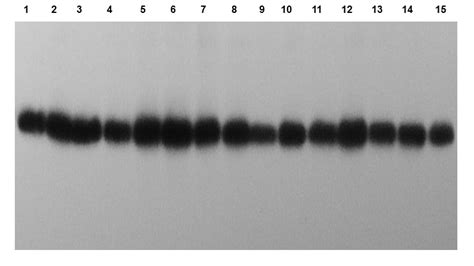 Human Tissue Northern Blot – Zyagen