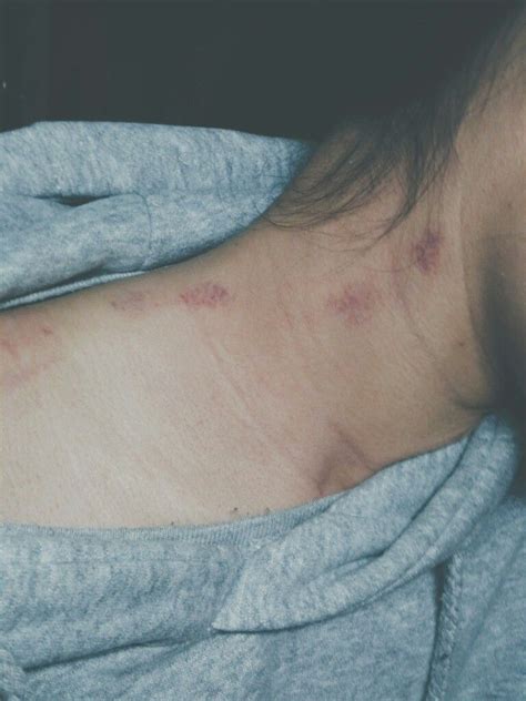 Hickey Kiss #Girlfriend | Boyfriend and girlfriend kissing, Hickies neck boys and girl, Hickies