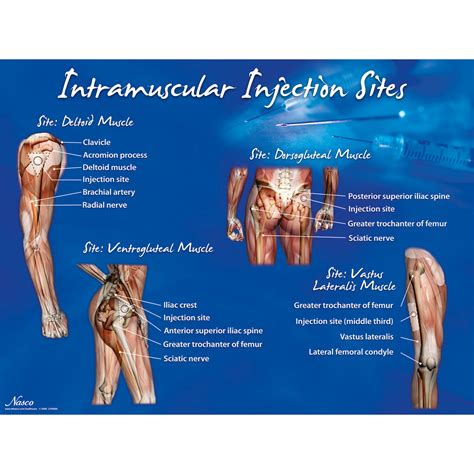 Intravenous Injection Sites