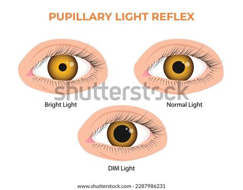 Pupillary Reflex Diagram