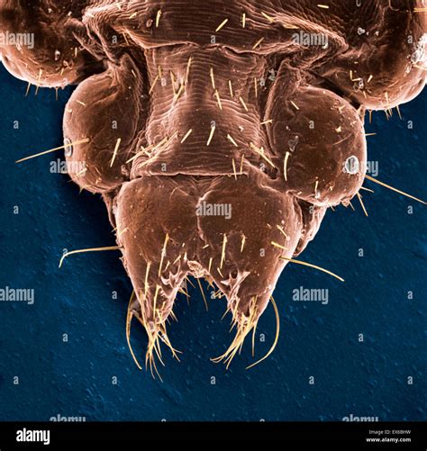 Body louse microscope hi-res stock photography and images - Alamy