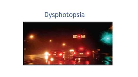 Cataract | Xpress-CataractNews | Dysphotopsia Visual Symptoms