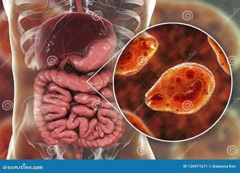 Balantidium Coli Protozoan in Large Intestine Stock Illustration - Illustration of ciliated ...