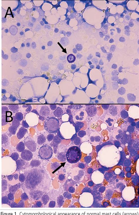 Figure 1 from Mast Cells as Key Players in Allergy and Inflammation. | Semantic Scholar