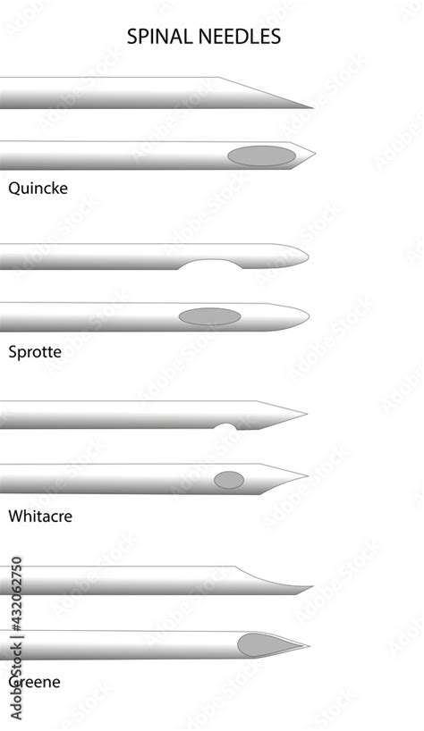 Spinal Needle. Different types of spinal needles side profile view. Stock Illustration | Adobe Stock