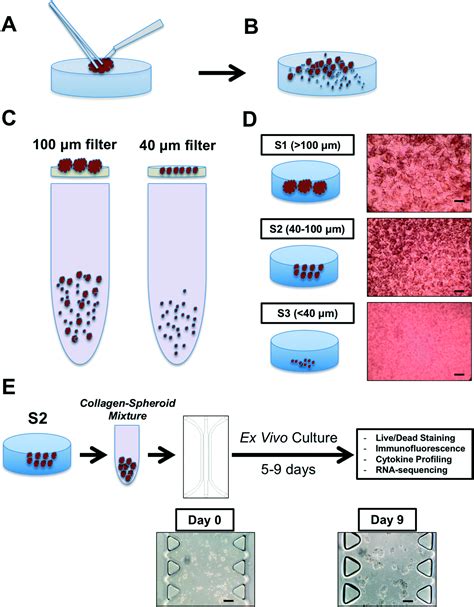 3D microfluidic ex vivo culture of organotypic tumor spheroids to model ...