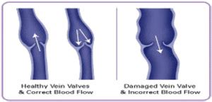 Venous Anatomy | Center for Venous Disease