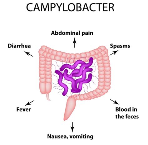 CIENCIASMEDICASNEWS: Campylobacter infection outbreak linked to puppies