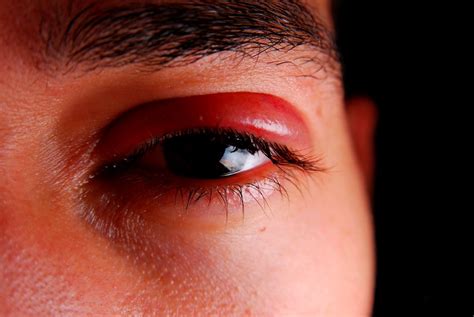 Eye Symptoms and How to Recognize Them – The Operating Room Global (TORG)