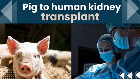 Pig-to-Human kidney Transplant ! | TheHealthSite.com