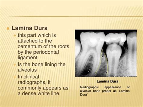 Alveolar Bone