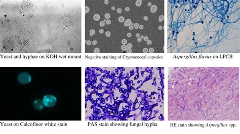 Fungal Staining Methods and Uses • Microbe Online