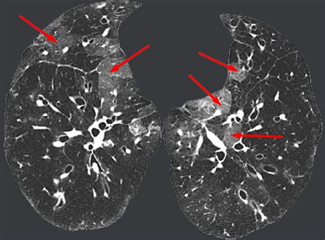 Chest Radiology