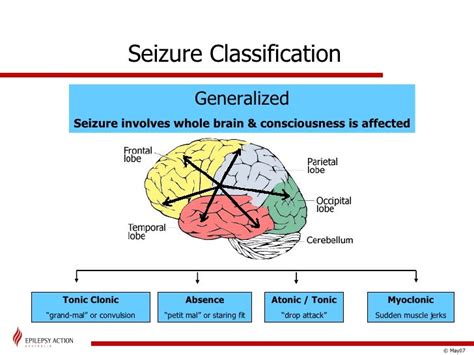 Epilepsy and Tuberous Sclerosis