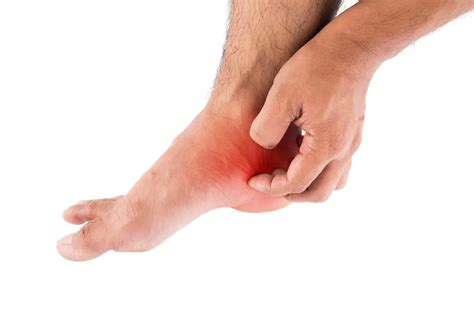 Foot rash | causes, symptoms, home remedies & treatment, pictures