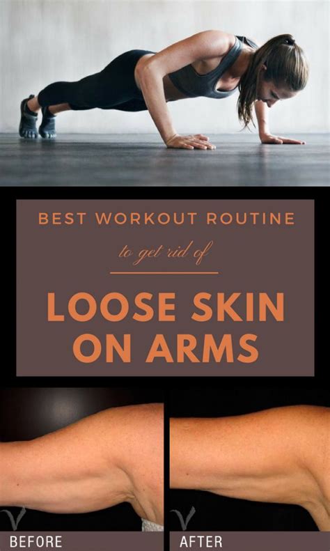 Best Workout Routine to Get Rid of Loose Skin on Arms - InstaFitness.net | Loose skin, Skin ...